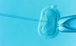 Imagen de reproducción asistida en laboratorio